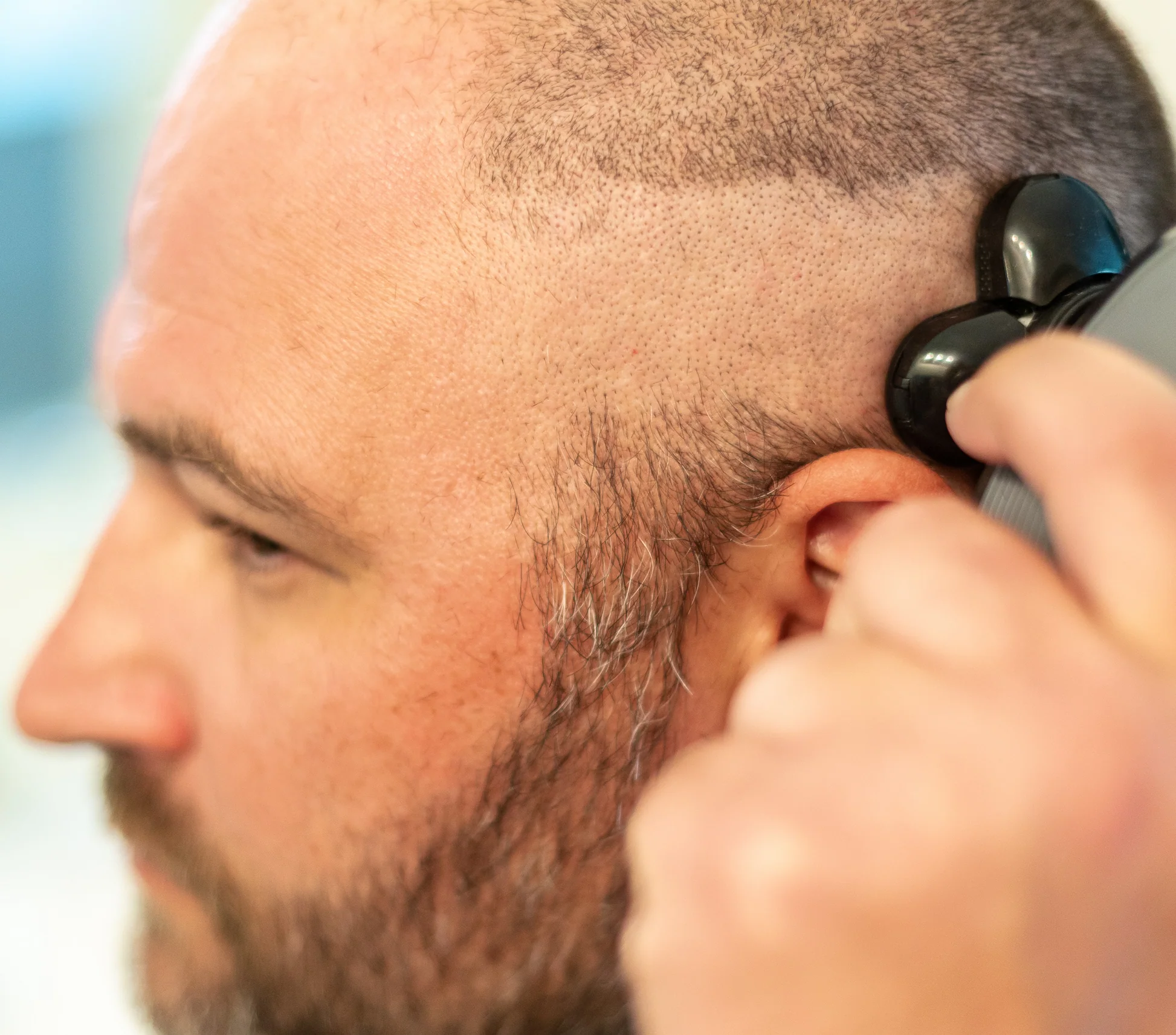 FlexSeries® Pro: Hodebarbering alt-i-ett sett