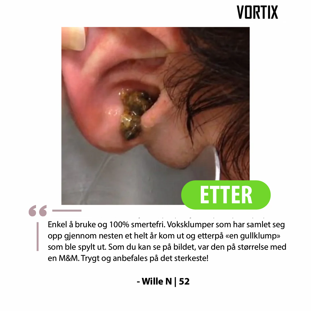 VORTIX Elektrisk sett for fjerning av ørevoks