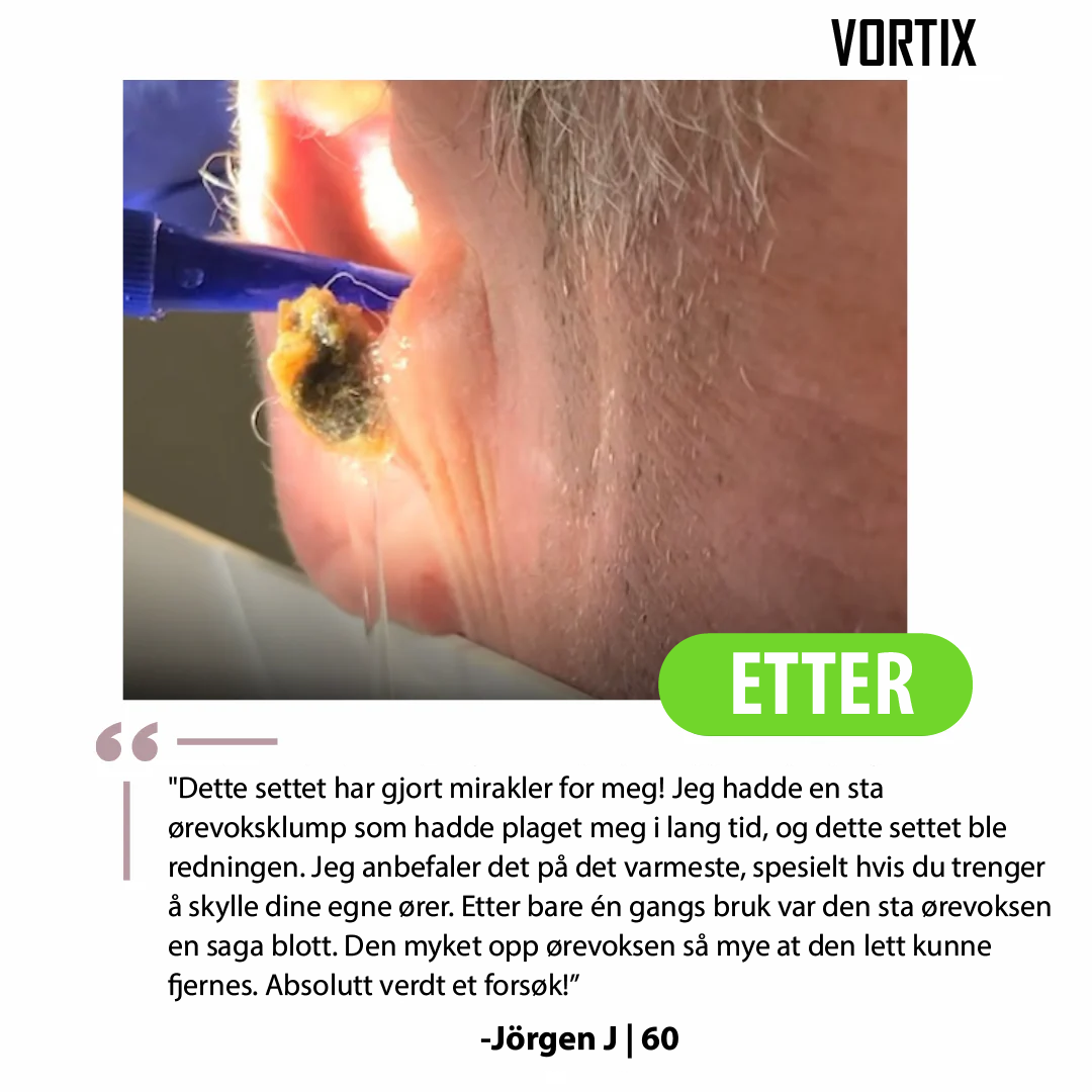 VORTIX Elektrisk sett for fjerning av ørevoks