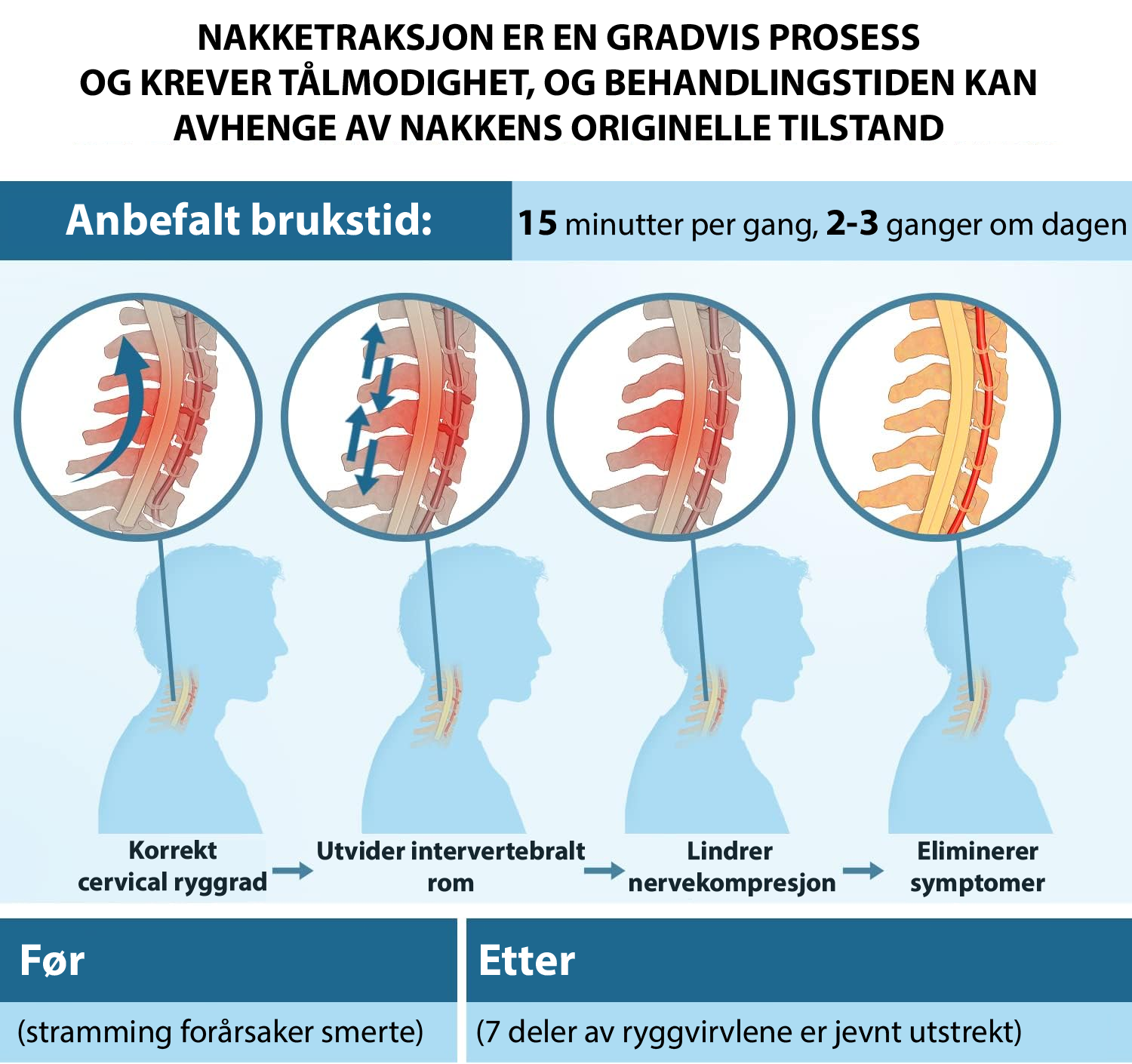 CERVIFLEX Nakkestrekker