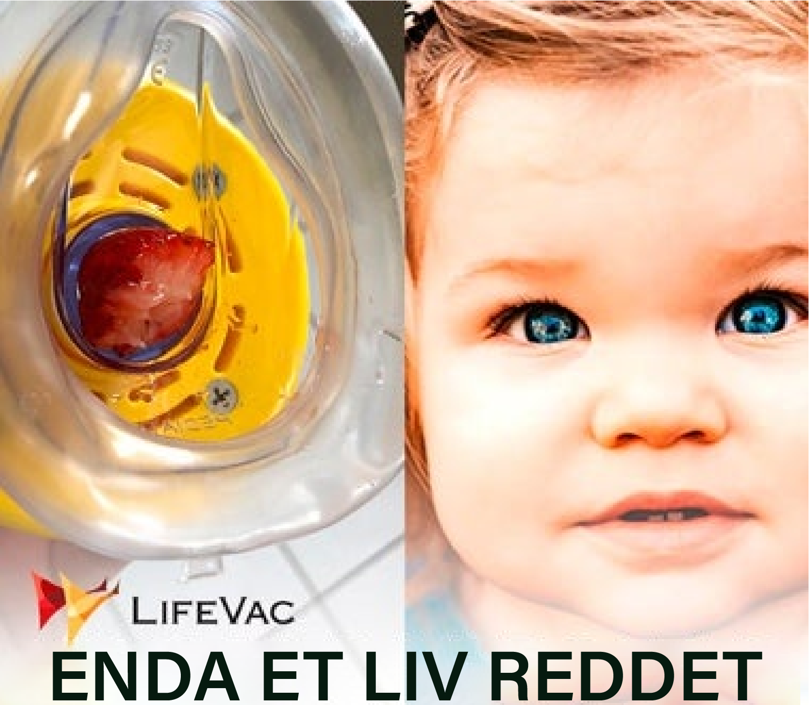 Airway Clear™
