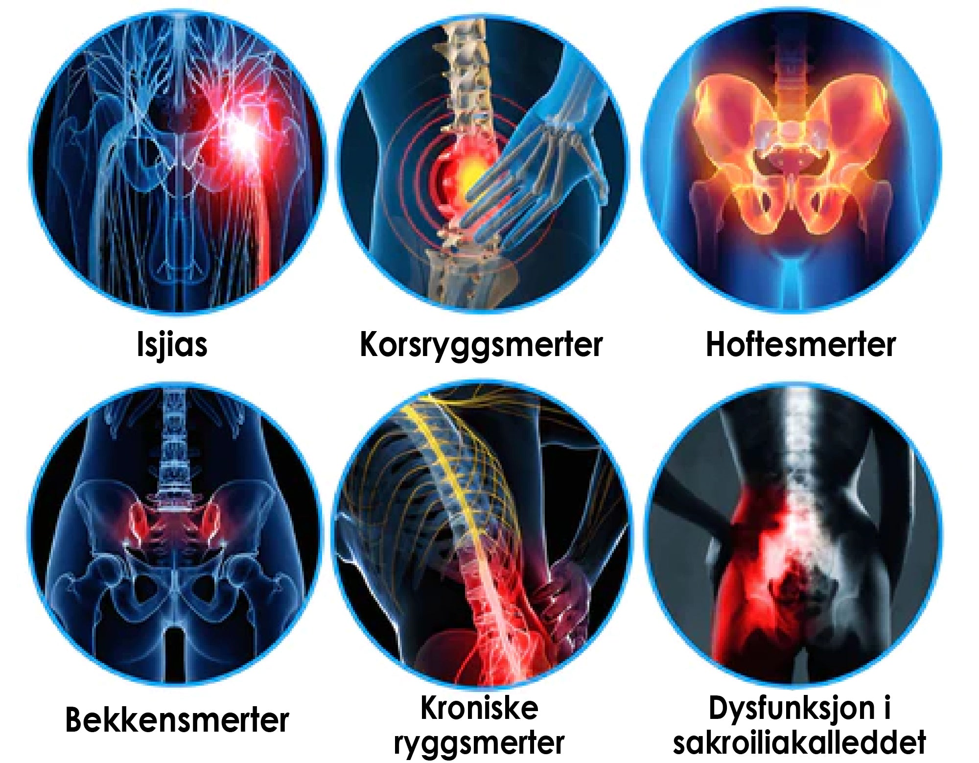 Beltec™ - Mot isjias og ryggsmerter