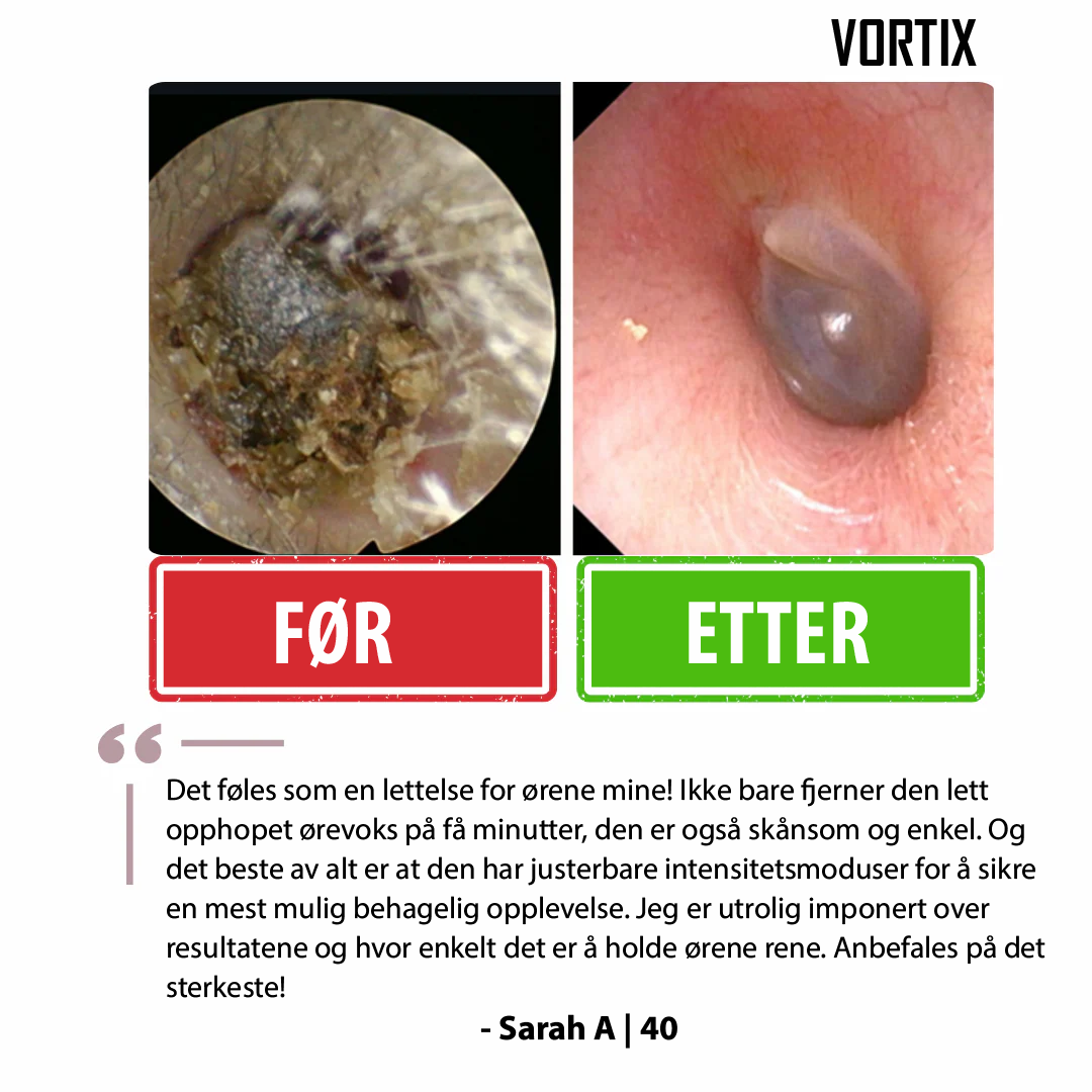 VORTIX Elektrisk sett for fjerning av ørevoks